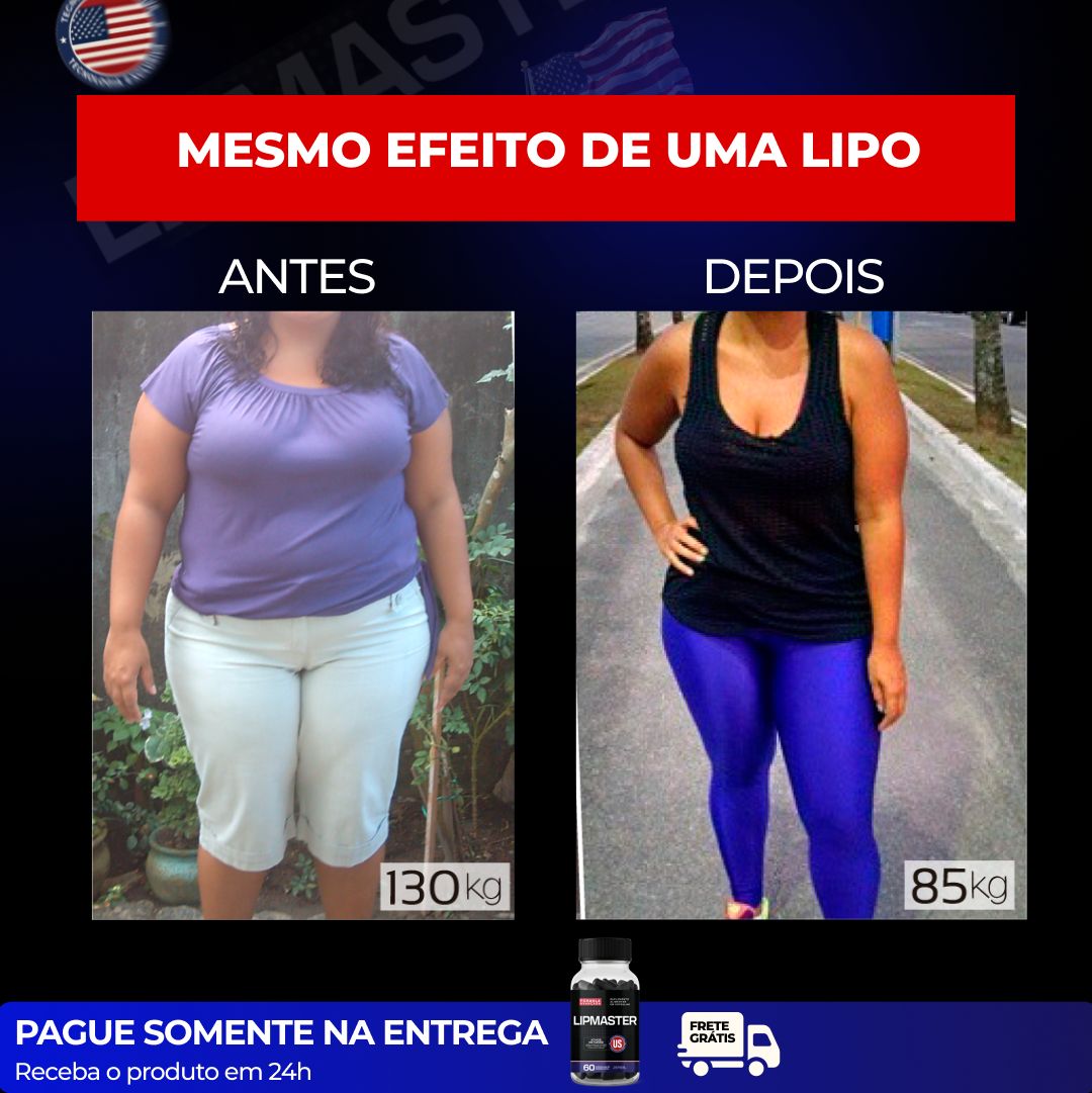 Antes e Depois Juliana Mendes